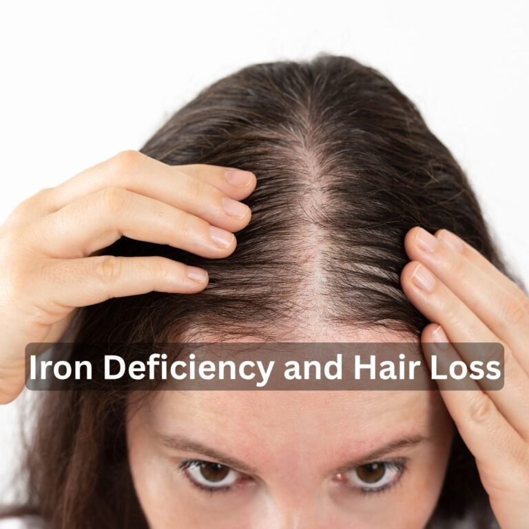 Iron Deficiency and Hair Loss