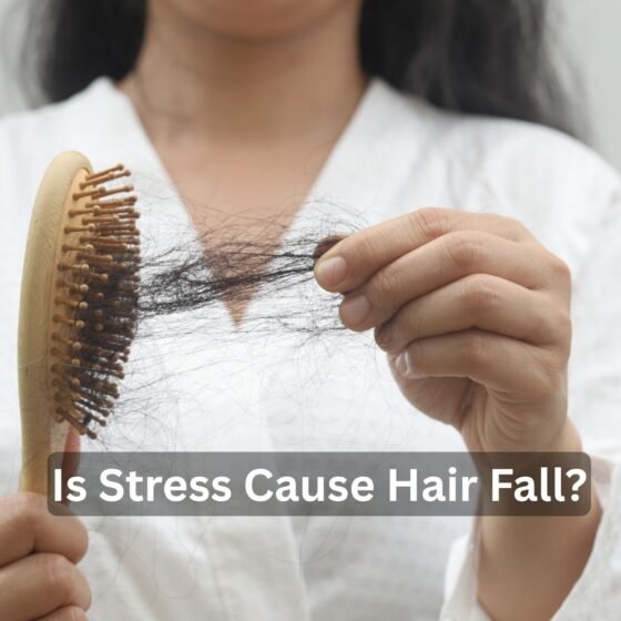 Is Stress Cause Hair Fall